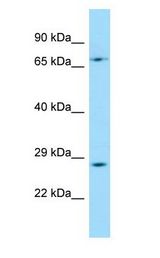 TFPT / Amida Antibody - TFPT / Amida antibody Western Blot of HT1080 cell lysate.  This image was taken for the unconjugated form of this product. Other forms have not been tested.