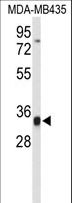 TFPT / Amida Antibody - Western blot of TFPT Antibody in MDA-MB435 cell line lysates (35 ug/lane). TFPT (arrow) was detected using the purified antibody.