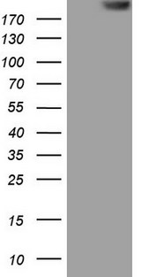 TG / Thyroglobulin Antibody - HEK293T cells were transfected with the pCMV6-ENTRY control. (Left lane) or pCMV6-ENTRY TG. (Right lane) cDNA for 48 hrs and lysed. Equivalent amounts of cell lysates. (5 ug per lane) were separated by SDS-PAGE and immunoblotted with anti-TG.