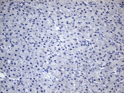 TG / Thyroglobulin Antibody - Immunohistochemical staining of paraffin-embedded Human pancreas tissue within the normal limits using anti-TG mouse monoclonal antibody. This figure shows negative staining. (Heat-induced epitope retrieval by 1mM EDTA in 10mM Tris buffer. (pH8.5) at 120°C for 3 min. (1:2000)
