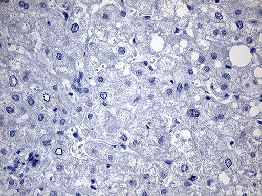 TG / Thyroglobulin Antibody - Immunohistochemical staining of paraffin-embedded Human liver tissue within the normal limits using anti-TG mouse monoclonal antibody.This figure shows negative staining. (Heat-induced epitope retrieval by 1mM EDTA in 10mM Tris buffer. (pH8.5) at 120°C for 3 min. (1:2000)