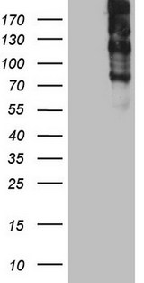 TG / Thyroglobulin Antibody - HEK293T cells were transfected with the pCMV6-ENTRY control. (Left lane) or pCMV6-ENTRY TG. (Right lane) cDNA for 48 hrs and lysed. Equivalent amounts of cell lysates. (5 ug per lane) were separated by SDS-PAGE and immunoblotted with anti-TG. (1:2000)