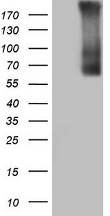 TG / Thyroglobulin Antibody - HEK293T cells were transfected with the pCMV6-ENTRY control (Left lane) or pCMV6-ENTRY TG (Right lane) cDNA for 48 hrs and lysed. Equivalent amounts of cell lysates (5 ug per lane) were separated by SDS-PAGE and immunoblotted with anti-TG.