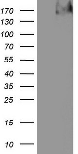 TG / Thyroglobulin Antibody - HEK293T cells were transfected with the pCMV6-ENTRY control. (Left lane) or pCMV6-ENTRY TG. (Right lane) cDNA for 48 hrs and lysed. Equivalent amounts of cell lysates. (5 ug per lane) were separated by SDS-PAGE and immunoblotted with anti-TG.