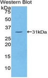 TG / Thyroglobulin Antibody - Western blot of recombinant TG / Thyroglobulin.  This image was taken for the unconjugated form of this product. Other forms have not been tested.