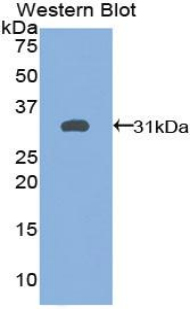 TG / Thyroglobulin Antibody - Western blot of recombinant TG / Thyroglobulin.  This image was taken for the unconjugated form of this product. Other forms have not been tested.