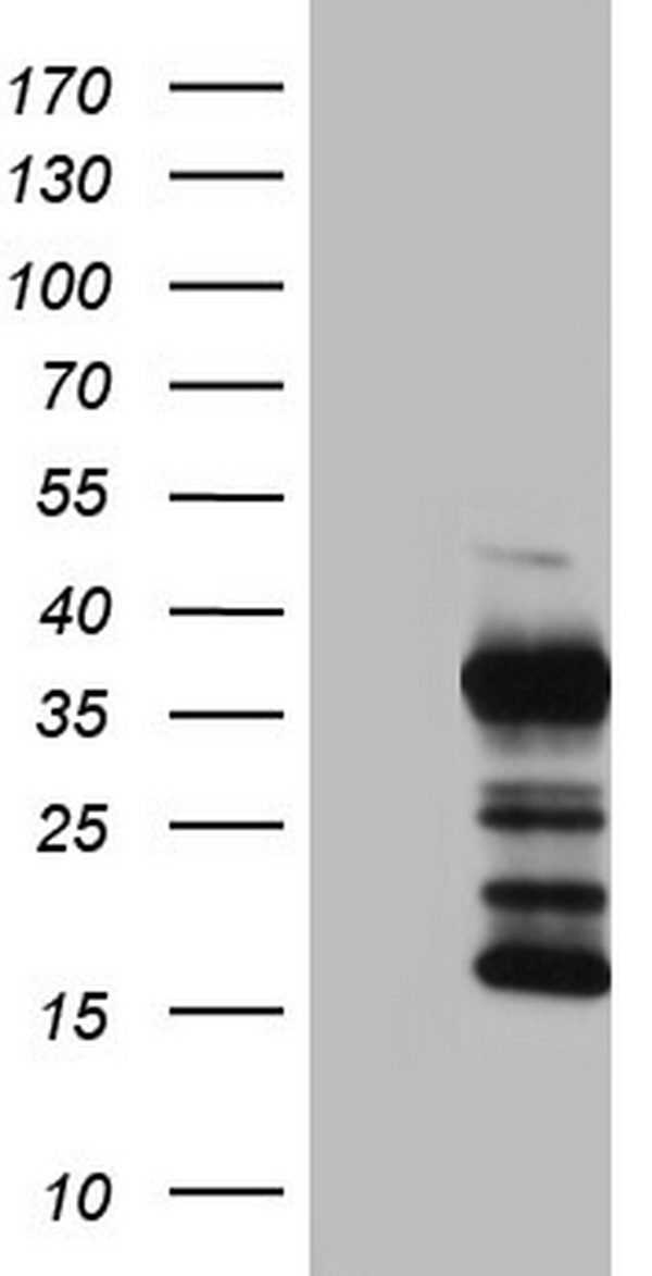 TG / Thyroglobulin Antibody - Human recombinant protein fragment corresponding to amino acids 2511-2768 of human TG (NP_003226) produced in E.coli.