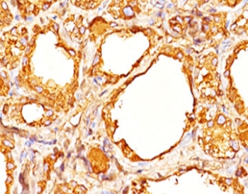 TG / Thyroglobulin Antibody - Thyroglobulin antibody TGB04 + TGB05 immunohistochemistry thyroid.  This image was taken for the unmodified form of this product. Other forms have not been tested.