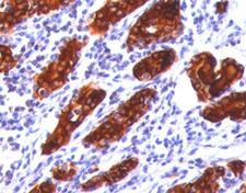 TG / Thyroglobulin Antibody - Thyroglobulin antibody 2H11 or TGB04 immunohistochemistry thyroid.  This image was taken for the unmodified form of this product. Other forms have not been tested.