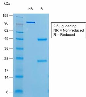 TG / Thyroglobulin Antibody - SDS-PAGE Analysis of Purified Thyroglobulin Mouse Recombinant Monoclonal Antibody (r6E1). Confirmation of Purity and Integrity of Antibody.
