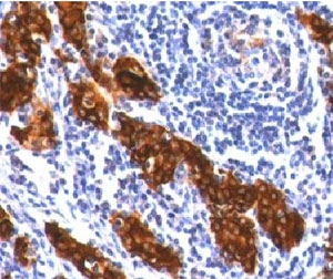TG / Thyroglobulin Antibody - IHC testing of FFPE thyroid tissue stained with Thyroglobulin antibody (clone TG157-2).  This image was taken for the unmodified form of this product. Other forms have not been tested.
