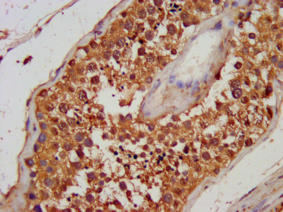 TG / Thyroglobulin Antibody - IHC image of TG Antibody diluted at 1:100 and staining in paraffin-embedded human testis tissue performed on a Leica BondTM system. After dewaxing and hydration, antigen retrieval was mediated by high pressure in a citrate buffer (pH 6.0). Section was blocked with 10% normal goat serum 30min at RT. Then primary antibody (1% BSA) was incubated at 4°C overnight. The primary is detected by a biotinylated secondary antibody and visualized using an HRP conjugated SP system.