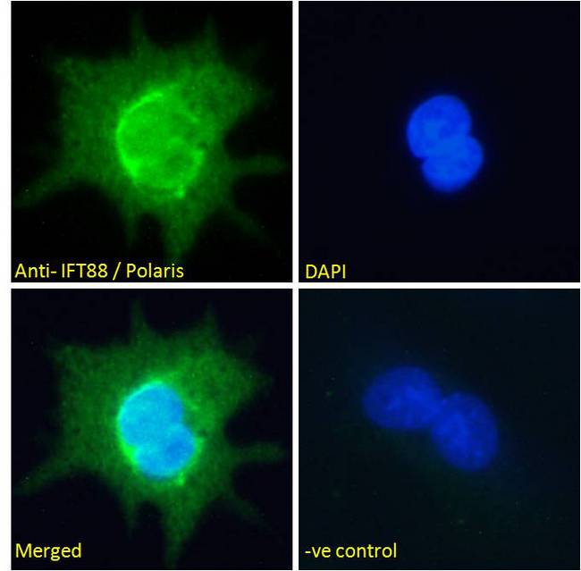 TG737 / IFT88 Antibody - IFT88 / Polaris Antibody Immunofluorescence analysis of paraformaldehyde fixed HepG2 cells, permeabilized with 0.15% Triton. Primary incubation 1hr (10ug/ml) followed by Alexa Fluor 488 secondary antibody (2ug/ml), showing nuclear and cytoplasmic staining. The nuclear stain is DAPI (blue). Negative control: Unimmunized goat IgG (10ug/ml) followed by Alexa Fluor 488 secondary antibody (2ug/ml).