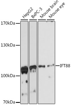 TG737 / IFT88 Antibody - Western blot analysis of extracts of various cell lines, using IFT88 antibody at 1:3000 dilution. The secondary antibody used was an HRP Goat Anti-Rabbit IgG (H+L) at 1:10000 dilution. Lysates were loaded 25ug per lane and 3% nonfat dry milk in TBST was used for blocking. An ECL Kit was used for detection and the exposure time was 90s.