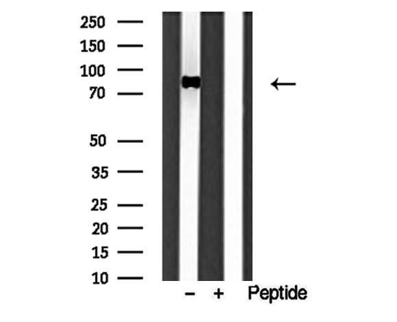 TG737 / IFT88 Antibody - Western blot analysis of extracts of HL-60 cells using IFT88 antibody.