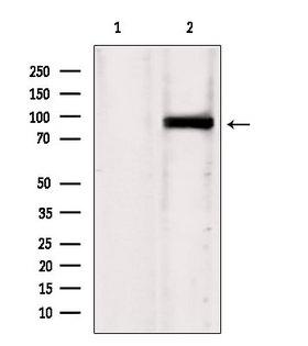 TG737 / IFT88 Antibody - Western blot analysis of extracts of HepG2 cells using IFT88 antibody. Lane 1 was treated with the blocking peptide.