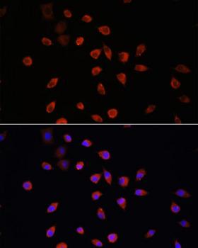TG737 / IFT88 Antibody - Immunofluorescence analysis of L929 cells using IFT88 Polyclonal Antibody at dilution of 1:100.Blue: DAPI for nuclear staining.