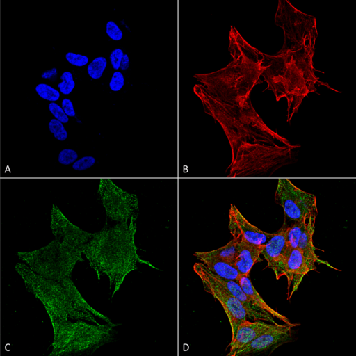 TG737 / IFT88 Antibody - Immunocytochemistry/Immunofluorescence analysis using Rabbit Anti-IFT88 Polyclonal Antibody. Tissue: Neuroblastoma cell line (SK-N-BE). Species: Human. Fixation: 4% Formaldehyde for 15 min at RT. Primary Antibody: Rabbit Anti-IFT88 Polyclonal Antibody  at 1:100 for 60 min at RT. Secondary Antibody: Goat Anti-Rabbit ATTO 488 at 1:100 for 60 min at RT. Counterstain: Phalloidin Texas Red F-Actin stain; DAPI (blue) nuclear stain at 1:1000, 1:5000 for 60 min at RT, 5 min at RT. Localization: Cytoplasm, Cytoskeleton. Magnification: 60X. (A) DAPI nuclear stain. (B) Phalloidin Texas Red F-Actin stain. (C) IFT88 Antibody. (D) Composite.