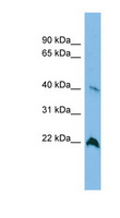 TGDS Antibody - TGDS antibody Western blot of A549 cell lysate. This image was taken for the unconjugated form of this product. Other forms have not been tested.