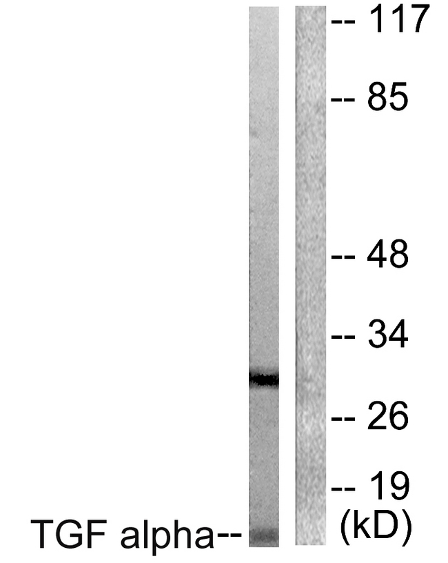 TGFA / TGF Alpha Antibody - Western blot analysis of lysates from COS7 cells, using TGF alpha Antibody. The lane on the right is blocked with the synthesized peptide.
