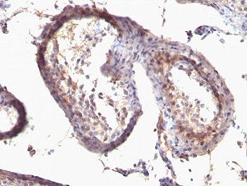 TGFA / TGF Alpha Antibody - Formalin-fixed, paraffin-embedded human testicular carcinoma stained with anti-TGF alpha antibody (SPM542).  This image was taken for the unmodified form of this product. Other forms have not been tested.