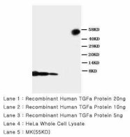 TGFA / TGF Alpha Antibody -  This image was taken for the unconjugated form of this product. Other forms have not been tested.