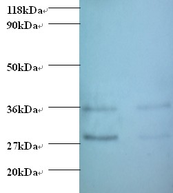 TGFA / TGF Alpha Antibody - Western blot of transforming growth factor alpha antibody at 2 ug/ml. Lane 1: EC109 whole cell lysate. Lane 2: 293T whole cell lysate. Secondary: Goat polyclonal to Rabbit IgG at 1:15000 dilution. Predicted band size: 18 kDa. Observed band size: 30 kDa Additional bands at: 35 kDa. We are unsure as to the identity of this extra band.  This image was taken for the unconjugated form of this product. Other forms have not been tested.