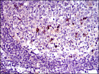TGFB1 / TGF Beta 1 Antibody - IHC of paraffin-embedded lymphoid tissue tissues using TGFb1 mouse monoclonal antibody with DAB staining.