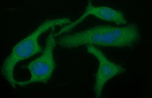 TGFB1 / TGF Beta 1 Antibody - Immunofluorescent staining of HeLa cells using anti-TGFB1 mouse monoclonal antibody.