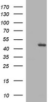 TGFB1 / TGF Beta 1 Antibody - HEK293T cells were transfected with the pCMV6-ENTRY control (Left lane) or pCMV6-ENTRY TGFB1 (Right lane) cDNA for 48 hrs and lysed. Equivalent amounts of cell lysates (5 ug per lane) were separated by SDS-PAGE and immunoblotted with anti-TGFB1.