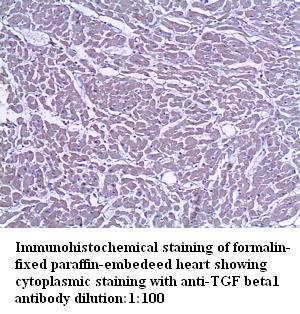 TGFB1 / TGF Beta 1 Antibody