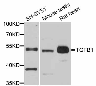 TGFB1 / TGF Beta 1 Antibody - Western blot analysis of extracts of various cell lines.