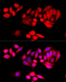 TGFB1 / TGF Beta 1 Antibody - Immunofluorescence analysis of HeLa cells using TGFB1 antibody at dilution of 1:100 (40x lens). Blue: DAPI for nuclear staining.
