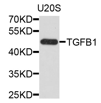TGFB1 / TGF Beta 1 Antibody - Western blot analysis of extracts of U2OS cells, using TGFB1 antibody at 1:1000 dilution. The secondary antibody used was an HRP Goat Anti-Rabbit IgG (H+L) at 1:10000 dilution. Lysates were loaded 25ug per lane and 3% nonfat dry milk in TBST was used for blocking. An ECL Kit was used for detection and the exposure time was 15s.