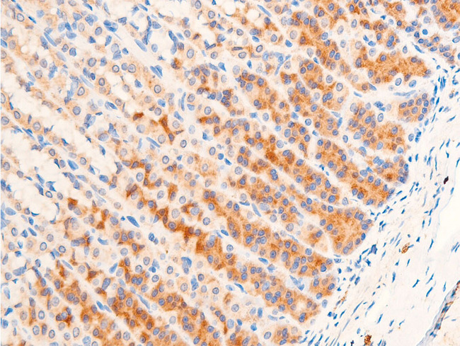TGFB1 / TGF Beta 1 Antibody - 1:100 staining rat gastric tissue by IHC-P. The tissue was formaldehyde fixed and a heat mediated antigen retrieval step in citrate buffer was performed. The tissue was then blocked and incubated with the antibody for 1.5 hours at 22°C. An HRP conjugated goat anti-rabbit antibody was used as the secondary.