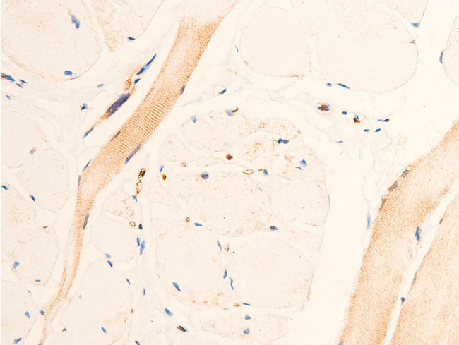 TGFB1 / TGF Beta 1 Antibody - 1:100 staining human heart tissue by IHC-P. The tissue was formaldehyde fixed and a heat mediated antigen retrieval step in citrate buffer was performed. The tissue was then blocked and incubated with the antibody for 1.5 hours at 22°C. An HRP conjugated goat anti-rabbit antibody was used as the secondary.