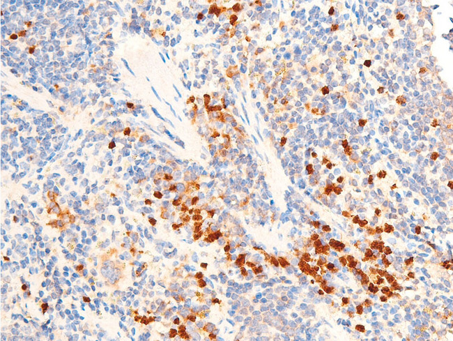 TGFB1 / TGF Beta 1 Antibody - 1:100 staining mouse spleen tissue by IHC-P. The tissue was formaldehyde fixed and a heat mediated antigen retrieval step in citrate buffer was performed. The tissue was then blocked and incubated with the antibody for 1.5 hours at 22°C. An HRP conjugated goat anti-rabbit antibody was used as the secondary.