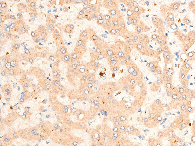 TGFB1 / TGF Beta 1 Antibody - 1:100 staining human liver tissue by IHC-P. The tissue was formaldehyde fixed and a heat mediated antigen retrieval step in citrate buffer was performed. The tissue was then blocked and incubated with the antibody for 1.5 hours at 22°C. An HRP conjugated goat anti-rabbit antibody was used as the secondary.