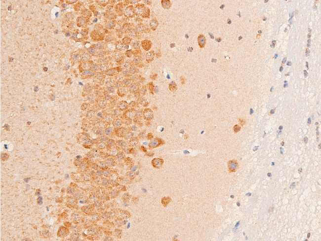 TGFB1 / TGF Beta 1 Antibody - 1:100 staining mouse brain tissue by IHC-P. The tissue was formaldehyde fixed and a heat mediated antigen retrieval step in citrate buffer was performed. The tissue was then blocked and incubated with the antibody for 1.5 hours at 22°C. An HRP conjugated goat anti-rabbit antibody was used as the secondary.