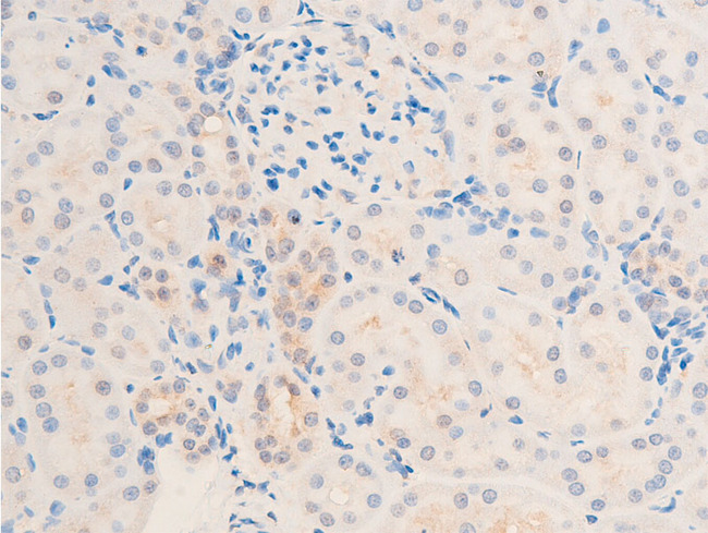 TGFB1 / TGF Beta 1 Antibody - 1:100 staining rat kidney tissue by IHC-P. The tissue was formaldehyde fixed and a heat mediated antigen retrieval step in citrate buffer was performed. The tissue was then blocked and incubated with the antibody for 1.5 hours at 22°C. An HRP conjugated goat anti-rabbit antibody was used as the secondary.