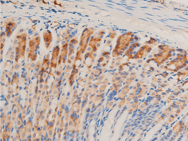 TGFB1 / TGF Beta 1 Antibody - 1:100 staining mouse gastric tissue by IHC-P. The tissue was formaldehyde fixed and a heat mediated antigen retrieval step in citrate buffer was performed. The tissue was then blocked and incubated with the antibody for 1.5 hours at 22°C. An HRP conjugated goat anti-rabbit antibody was used as the secondary.