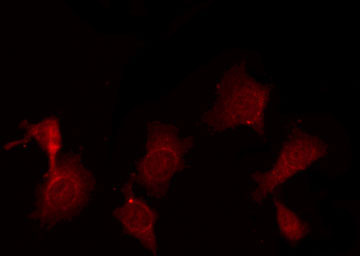 TGFB1 / TGF Beta 1 Antibody - Staining HepG2 cells by IF/ICC. The samples were fixed with PFA and permeabilized in 0.1% Triton X-100, then blocked in 10% serum for 45 min at 25°C. The primary antibody was diluted at 1:200 and incubated with the sample for 1 hour at 37°C. An Alexa Fluor 594 conjugated goat anti-rabbit IgG (H+L) Ab, diluted at 1/600, was used as the secondary antibody.