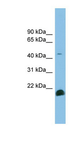 TGFB2 / TGF Beta2 Antibody - TGFB2 antibody Western blot of NCI-H226 cell lysate. This image was taken for the unconjugated form of this product. Other forms have not been tested.
