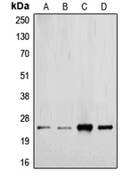 TGFB2 / TGF Beta2 Antibody - Western blot analysis of TGF beta 2 expression in MCF7 (A); HeLa (B); mouse kidney (C); rat placenta (D) whole cell lysates.