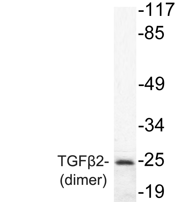 TGFB2 / TGF Beta2 Antibody - Western blot of TGF2 (L388) pAb in extracts from MDA-MB-435 cell.