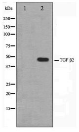 TGFB2 / TGF Beta2 Antibody - Western blot of TGF beta2 antibody