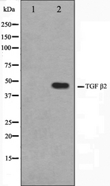 TGFB2 / TGF Beta2 Antibody - Western blot analysis of TGF beta2 antibody expression in mouse brain tissue lysates. The lane on the left is treated with the antigen-specific peptide.