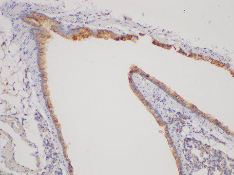 TGFB2 / TGF Beta2 Antibody - Immunohistochemistry of paraffin-embedded Mouse lung using TGFB2 Polycloanl Antibody at dilution of 1:200.