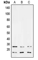 TGFB3 / TGF Beta3 Antibody - Western blot analysis of TGF beta 3 expression in MCF7 (A); NIH3T3 (B); PC12 (C) whole cell lysates.