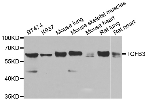 TGFB3 / TGF Beta3 Antibody - Western blot analysis of extracts of various cells.